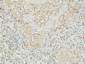 Anti-MUC16 Rabbit Polyclonal Antibody