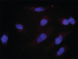 Anti-DNMT1 Antibody Pair