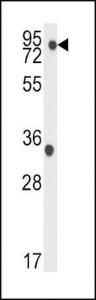 Anti-TBK1 Rabbit Polyclonal Antibody