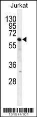 Anti-NKD2 Rabbit Polyclonal Antibody (FITC (Fluorescein Isothiocyanate))