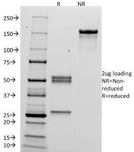 SDS-PAGE analysis of Anti-HCG alpha Antibody [HCGa/53] under non-reduced and reduced conditions; showing intact IgG and intact heavy and light chains, respectively. SDS-PAGE analysis confirms the integrity and purity of the Antibody