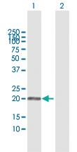 Anti-APRT Rabbit Polyclonal Antibody