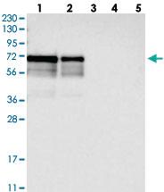 Anti-LTV1 Rabbit Polyclonal Antibody