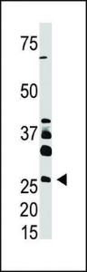 Anti-DKK4 Rabbit Polyclonal Antibody (AP (Alkaline Phosphatase))