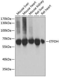 Anti-ETFDH Rabbit Polyclonal Antibody