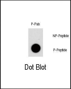 Anti-NR4A1 Rabbit Polyclonal Antibody (APC (Allophycocyanin))