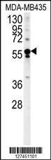 Anti-ARHGEF3 Rabbit Polyclonal Antibody (AP (Alkaline Phosphatase))