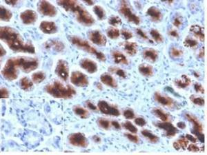 Immunohistochemical analysis of formalin-fixed, paraffin-embedded human stomach tissue using Anti-MUC1 Antibody [Mc5]. Inset: PBS instead of the primary antibody. Secondary antibody negative control.