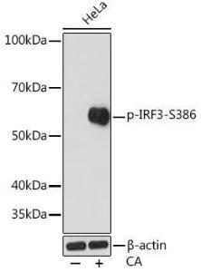 Western blot analysis of extracts of HeLa cells, using Anti-IRF3 (phospho Ser386) Antibody [ARC1539] (A305440) at 1:1000 dilution