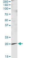 Anti-APRT Rabbit Polyclonal Antibody