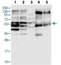 Anti-GADL1 Rabbit Polyclonal Antibody