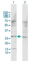 Anti-ADGRL1 Rabbit Polyclonal Antibody