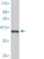 Anti-BTF3 Mouse Monoclonal Antibody [clone: 3C4-2E11]