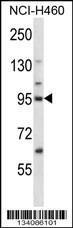 Anti-KIF2C Rabbit Polyclonal Antibody (FITC (Fluorescein Isothiocyanate))