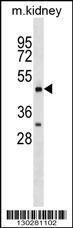 Anti-HCRTR2 Rabbit Polyclonal Antibody (Biotin)