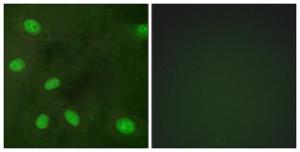 Immunofluorescence analysis of HeLa cells using Anti-GIRK1 (phospho Ser185) Antibody. The right hand panel represents a negative control, where the antibody was pre-incubated with the immunising peptide.