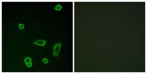 Immunofluorescence analysis of LOVO cells using Anti-MTR1L Antibody. The right hand panel represents a negative control, where the antibody was pre-incubated with the immunising peptide