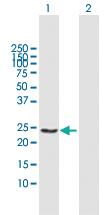 Anti-GSTA4 Mouse Polyclonal Antibody