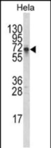 Anti-DTX1 Rabbit Polyclonal Antibody