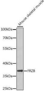 Western blot analysis of extracts of mouse skeletal muscle, using Anti-FRZB Antibody (A9927) at 1:1,000 dilution