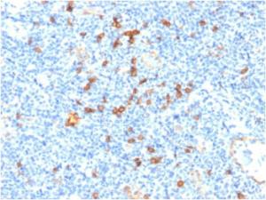 Immunohistochemical analysis of formalin-fixed, paraffin-embedded human tonsil using Anti-IL3RA Antibody [IL3RA/1531]