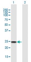 Anti-SSX4 Mouse Polyclonal Antibody