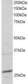 Anti-RAB11A Antibody (A83865) staining (2µg/ml) of mouse heart lysate (RIPA buffer, 30µg total protein per lane). Primary incubated for 1 hour. Detected by western blot using chemiluminescence.