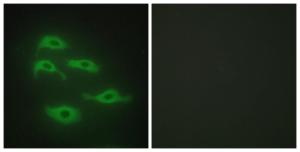 Immunofluorescence analysis of HepG2 cells using Anti-SERC3 Antibody. The right hand panel represents a negative control, where the antibody was pre-incubated with the immunising peptide