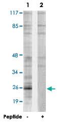 Anti-PPP1R2 Rabbit Polyclonal Antibody