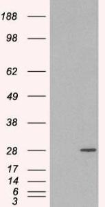 HEK293 overexpressing RAB11A(RC200352) and probed with Anti-RAB11A Antibody (A83865) (mock transfection in first lane), tested by Origene