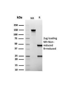 SDS-PAGE analysis of Anti-MUC1 Antibody [Mc5] under non-reduced and reduced conditions; showing intact IgG and intact heavy and light chains, respectively. SDS-PAGE analysis confirms the integrity and purity of the antibody.