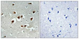 Immunohistochemical analysis of paraffin-embedded human brain carcinoma tissue using Anti-AFX Antibody. The right hand panel represents a negative control, where the antibody was pre-incubated with the immunising peptide.