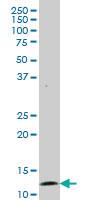 Anti-GHRL Mouse Monoclonal Antibody [clone: 4E5]