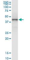 Anti-HLAA Polyclonal Antibody Pair