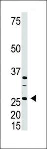 Anti-DKK4 Rabbit Polyclonal Antibody (AP (Alkaline Phosphatase))