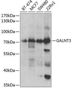 Western blot analysis of extracts of various cell lines, using Anti-GALNT3 Antibody (A6596) at 1:1,000 dilution