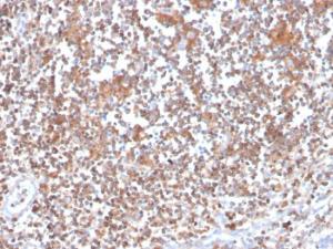 Antibody anti-PKC alpha 133 100 µg