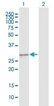 Anti-KLK3 Mouse Polyclonal Antibody