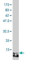 Anti-GHRL Mouse Monoclonal Antibody [clone: 4E5]