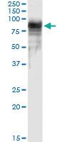 Anti-PTGS2 Polyclonal Antibody Pair