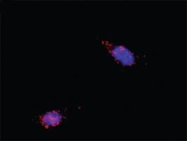 Anti-RAF1 Antibody Pair