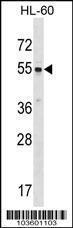 Anti-SRMS Rabbit Polyclonal Antibody (FITC (Fluorescein))