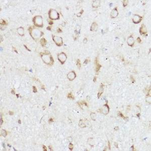 Immunohistochemistry analysis of paraffin-embedded mouse spinal cord using Anti-NEURL1B Antibody (A305441) at a dilution of 1:100 (40x lens). Perform high pressure antigen retrieval with 10 mM citrate buffer pH 6.0 before commencing with IHC staining protocol.