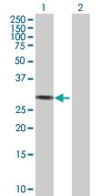 Anti-KLK3 Rabbit Polyclonal Antibody