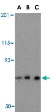 Anti-NCSTN Rabbit Polyclonal Antibody