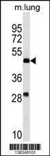 Anti-RNF150 Rabbit Polyclonal Antibody