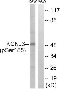 Western blot analysis of lysates from RAW264.7 cells treated with Insulin 0.01U/ml 15' using Anti-GIRK1 (phospho Ser185) Antibody. The right hand lane represents a negative control, where the antibody is blocked by the immunising peptide.