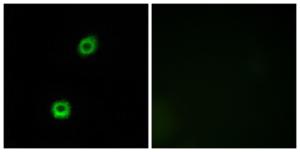 Immunofluorescence analysis of A549 cells using Anti-MARCKS Antibody. The right hand panel represents a negative control, where the antibody was pre-incubated with the immunising peptide.