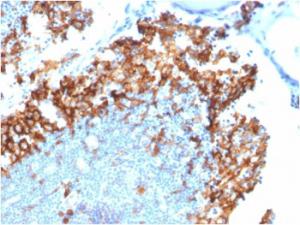 Immunohistochemical analysis of formalin-fixed, paraffin-embedded human lymph node using Anti-IL3RA Antibody [IL3RA/1531]