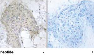 Anti-PPP1R2 Rabbit Polyclonal Antibody